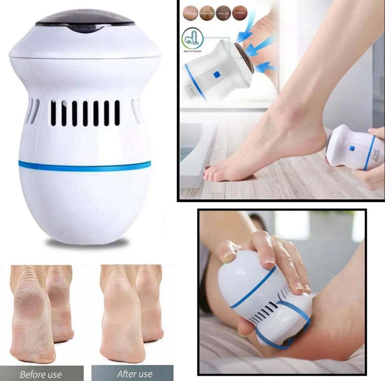 Portable Vaccum Foot Grinder